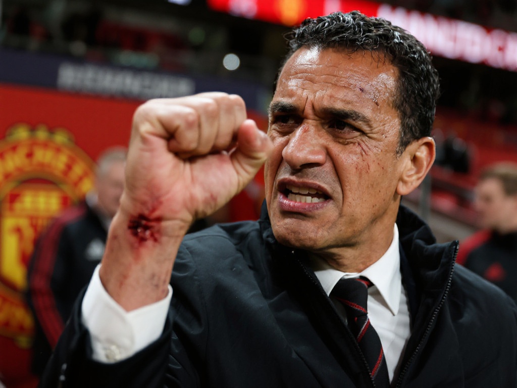 阿莫林拳头现新伤痕,怒批曼联阵容惹争议! 伤痕背后是否折射管理矛盾
谈及阿莫林拳